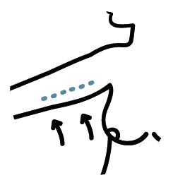 icon-koerper-oberarmstraffung